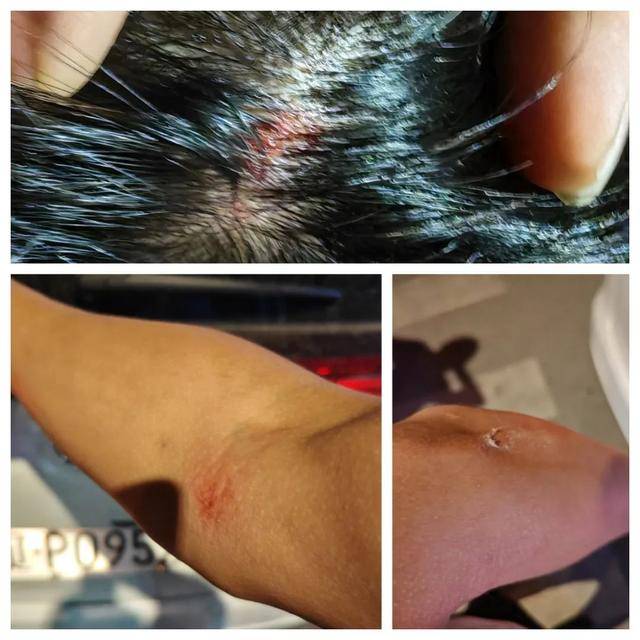 皇冠信用网怎么代理_向前一横！辽P0952警皇冠信用网怎么代理，救下5个孩子