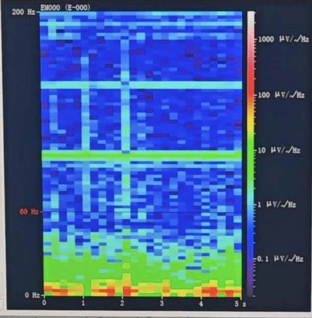 皇冠信用盘登1,登2,登3出租_山西首例皇冠信用盘登1,登2,登3出租！山西省人民医院成功实施脑机接口辅助功能区脑肿瘤切除手术